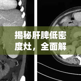 揭秘肝脾低密度灶，全面解读，助你从容应对疾病