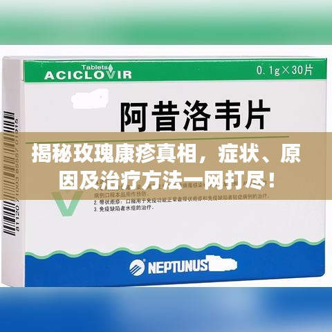 揭秘玫瑰康疹真相，症状、原因及治疗方法一网打尽！