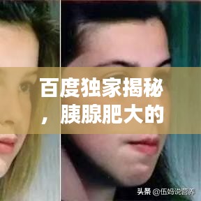 百度独家揭秘，胰腺肥大的真相与探索
