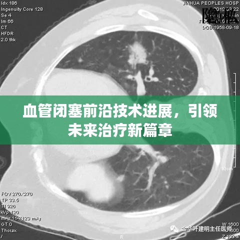 血管闭塞前沿技术进展，引领未来治疗新篇章
