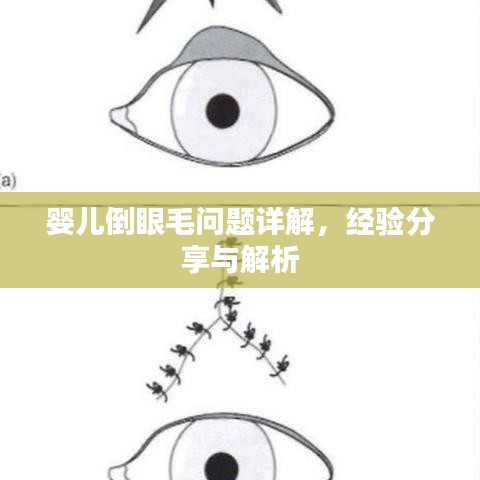 婴儿倒眼毛问题详解，经验分享与解析
