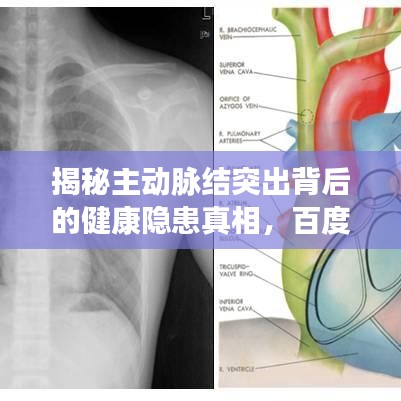 揭秘主动脉结突出背后的健康隐患真相，百度权威解读！